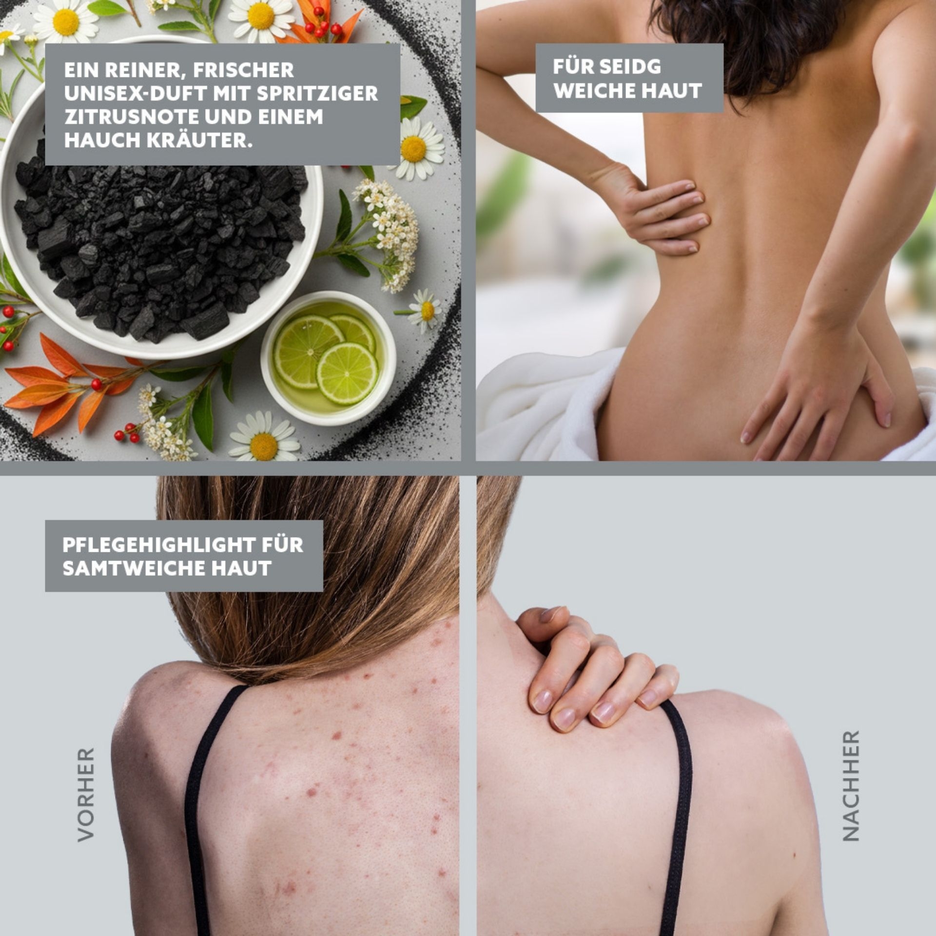 Vorher-Nachher Vergleich bei Hautunreinheiten am Ruecken mit Pflegeergebnis